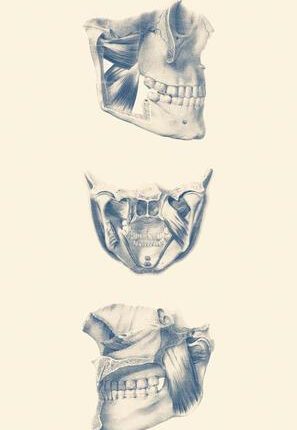 Vintage 14